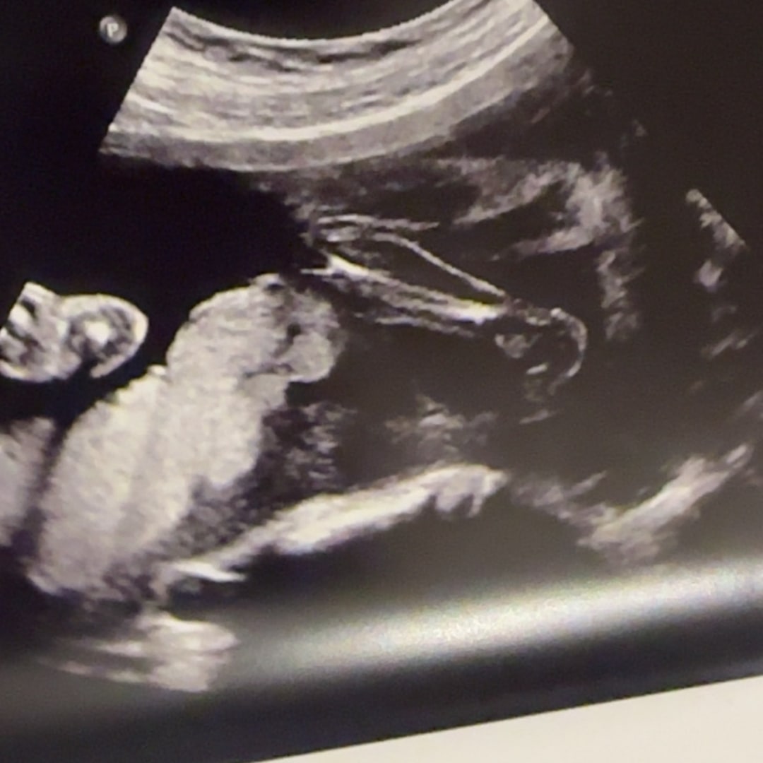 Photo shared by Rosanna for their Babylist baby registry.