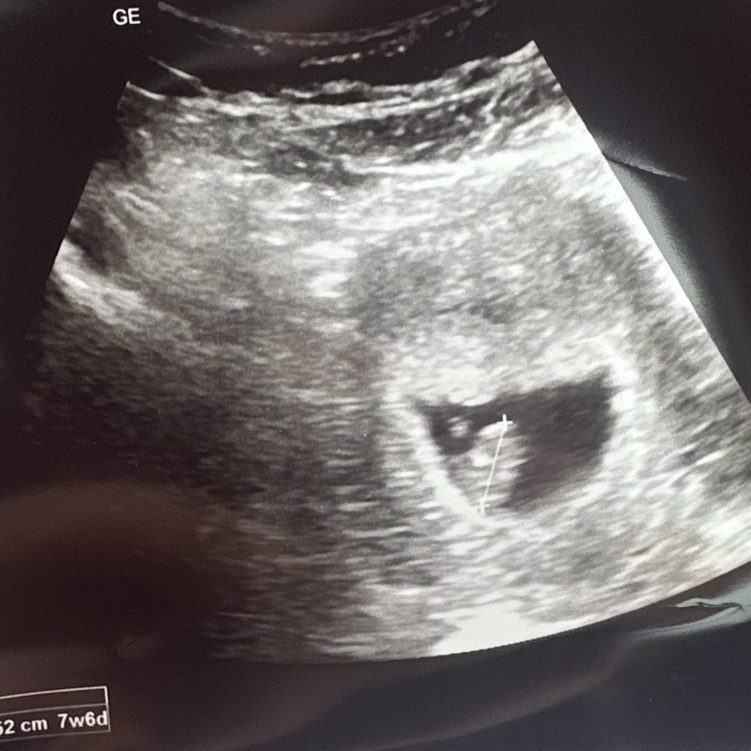 Photo shared by Madi for their Babylist baby registry.