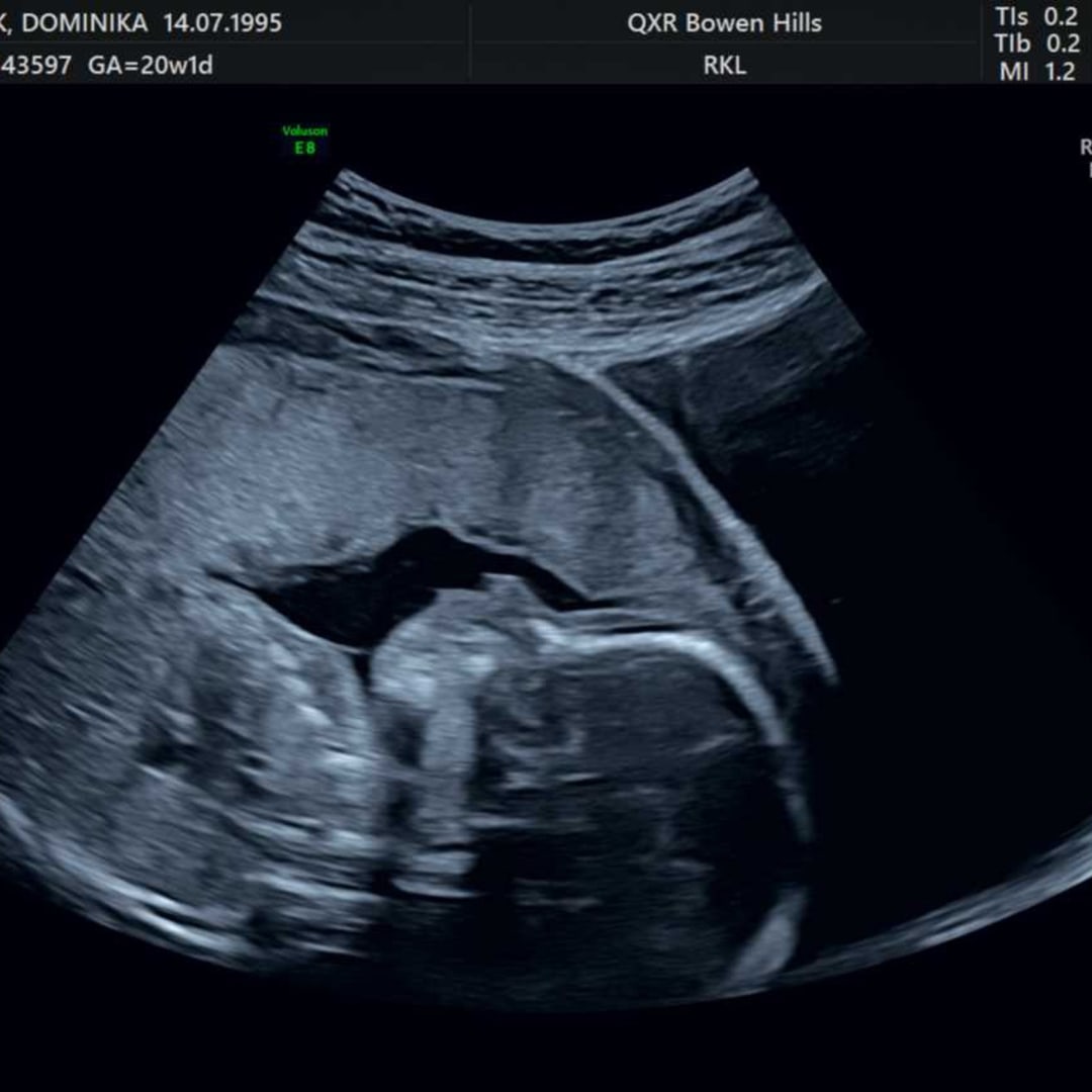 Photo shared by Dominica for their Babylist baby registry.