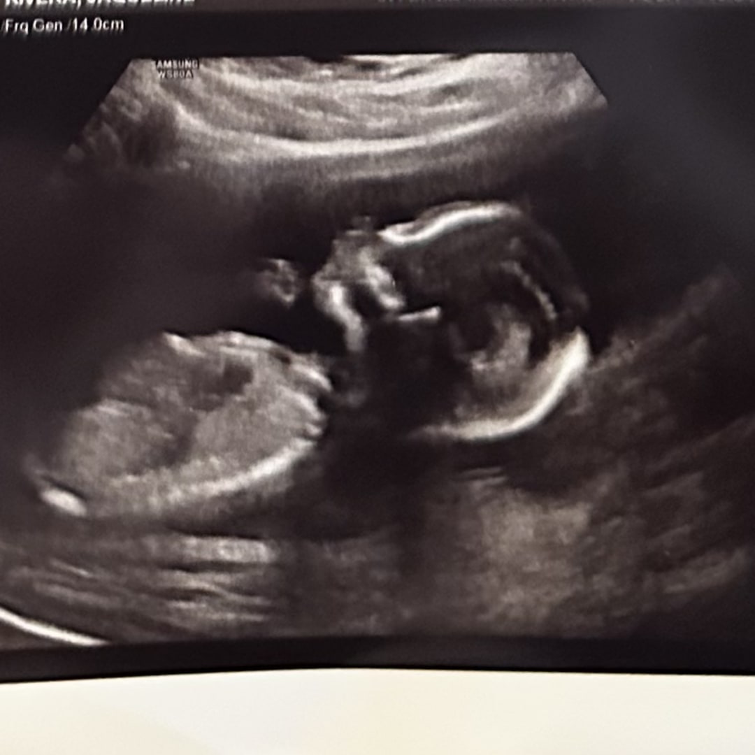 Photo shared by Jaqueline for their Babylist baby registry.