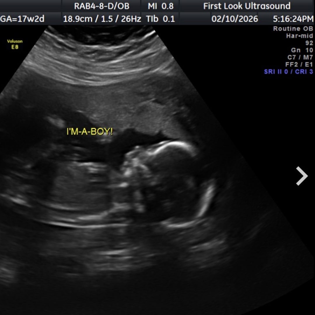 Photo shared by Kathryn for their Babylist baby registry.