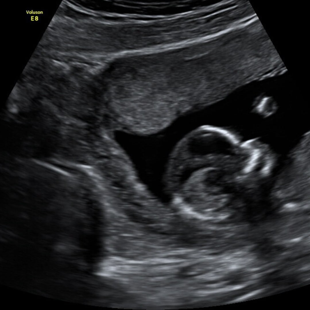 Photo shared by Chloe for their Babylist baby registry.