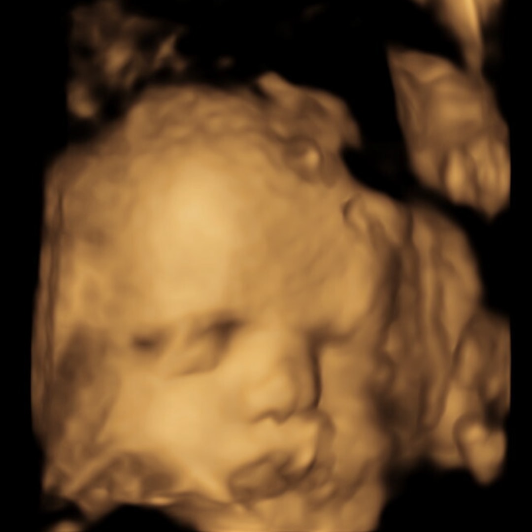 Photo shared by Leah for their Babylist baby registry.