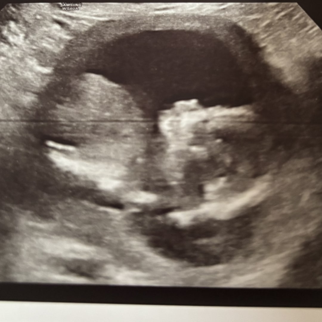 Photo shared by Erin for their Babylist baby registry.