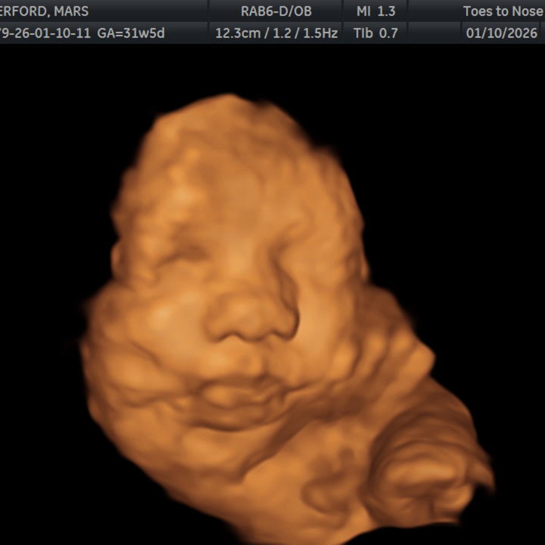 Photo shared by Mars for their Babylist baby registry.