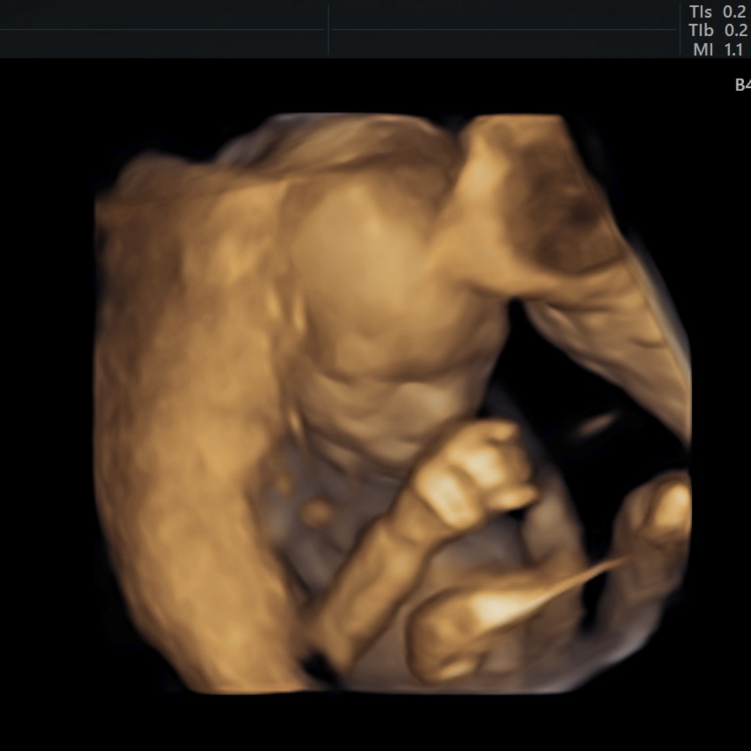 Photo shared by Sara for their Babylist baby registry.