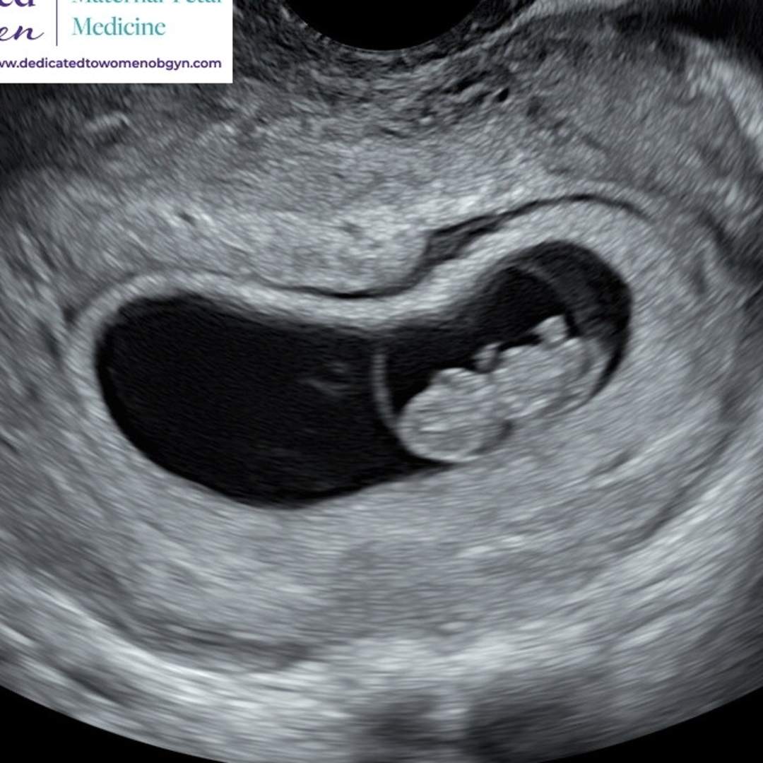 Photo shared by Eve for their Babylist baby registry.