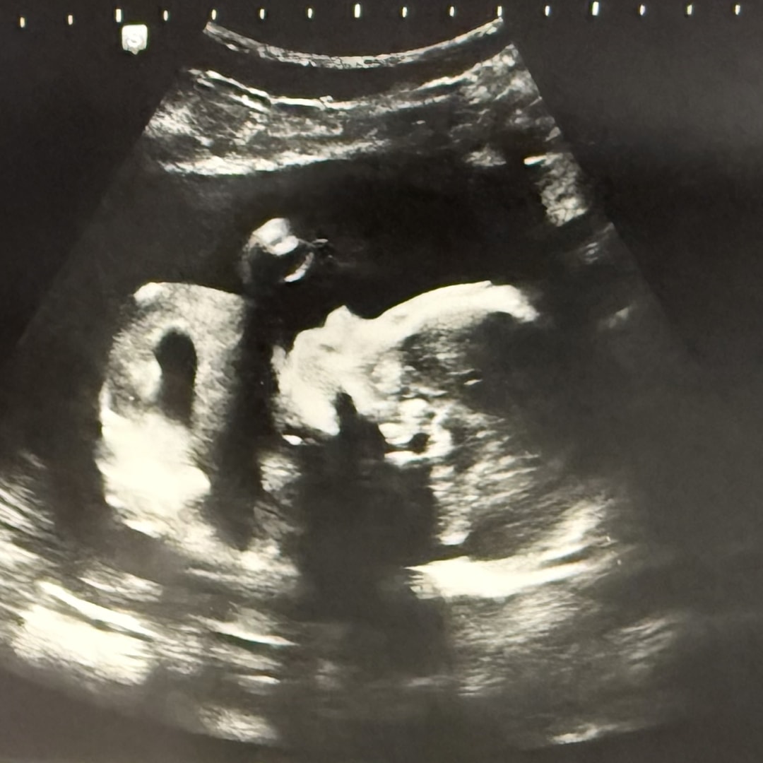 Photo shared by Anastasia for their Babylist baby registry.