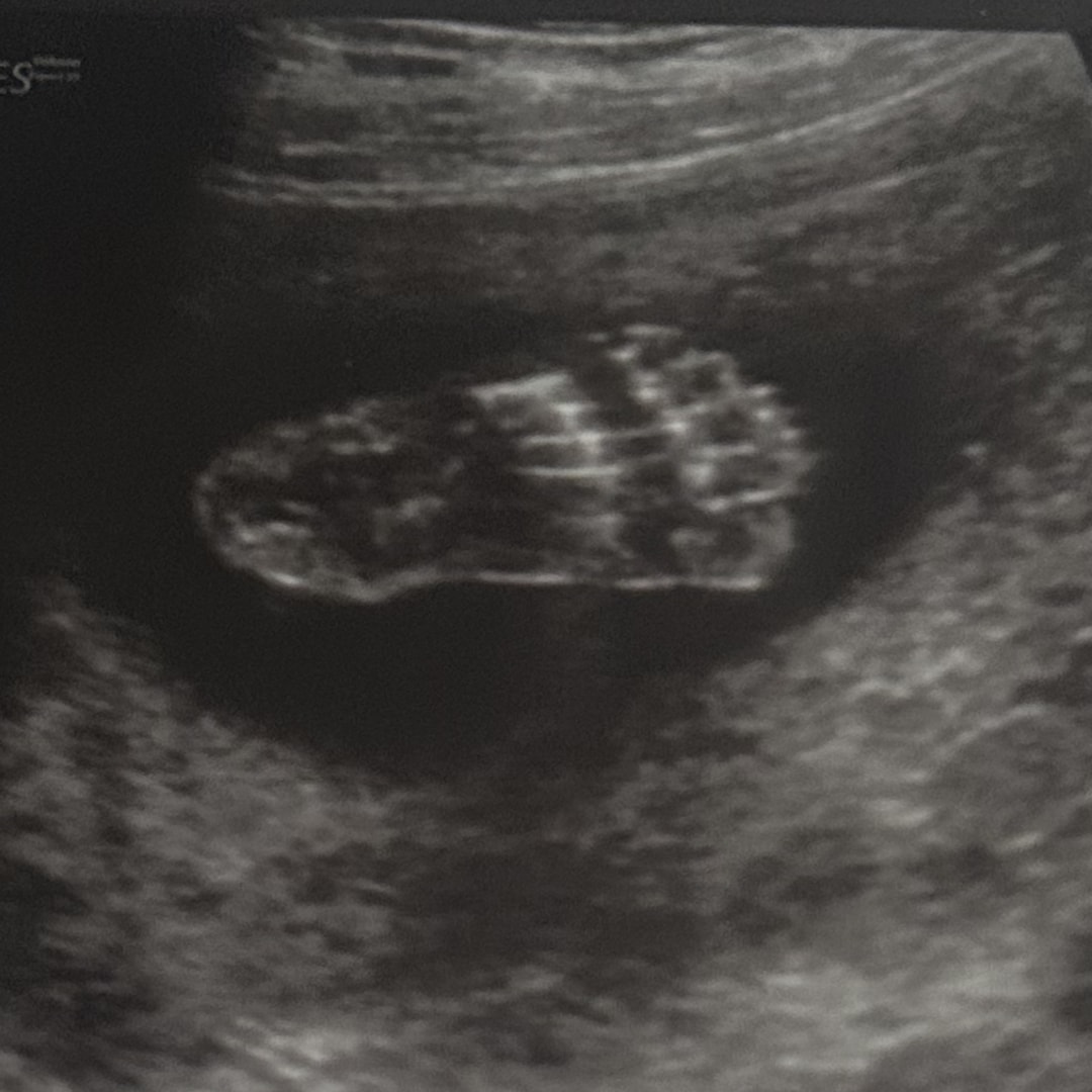 Photo shared by Quintessa for their Babylist baby registry.