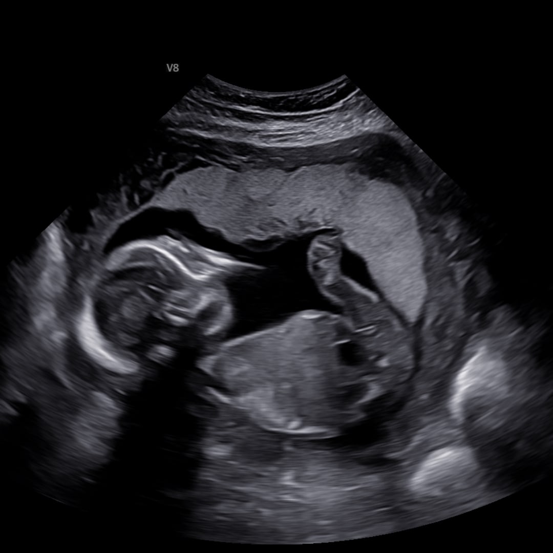 Photo shared by Casie for their Babylist baby registry.