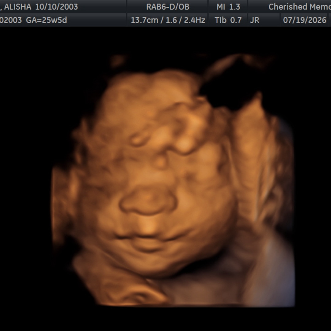 Photo shared by Alisha for their Babylist baby registry.