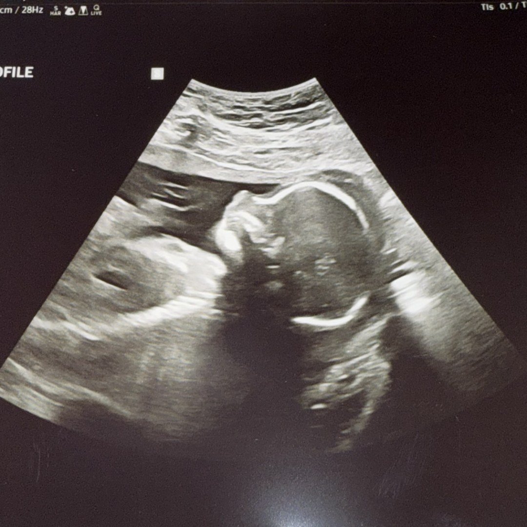 Photo shared by Kaylee for their Babylist baby registry.