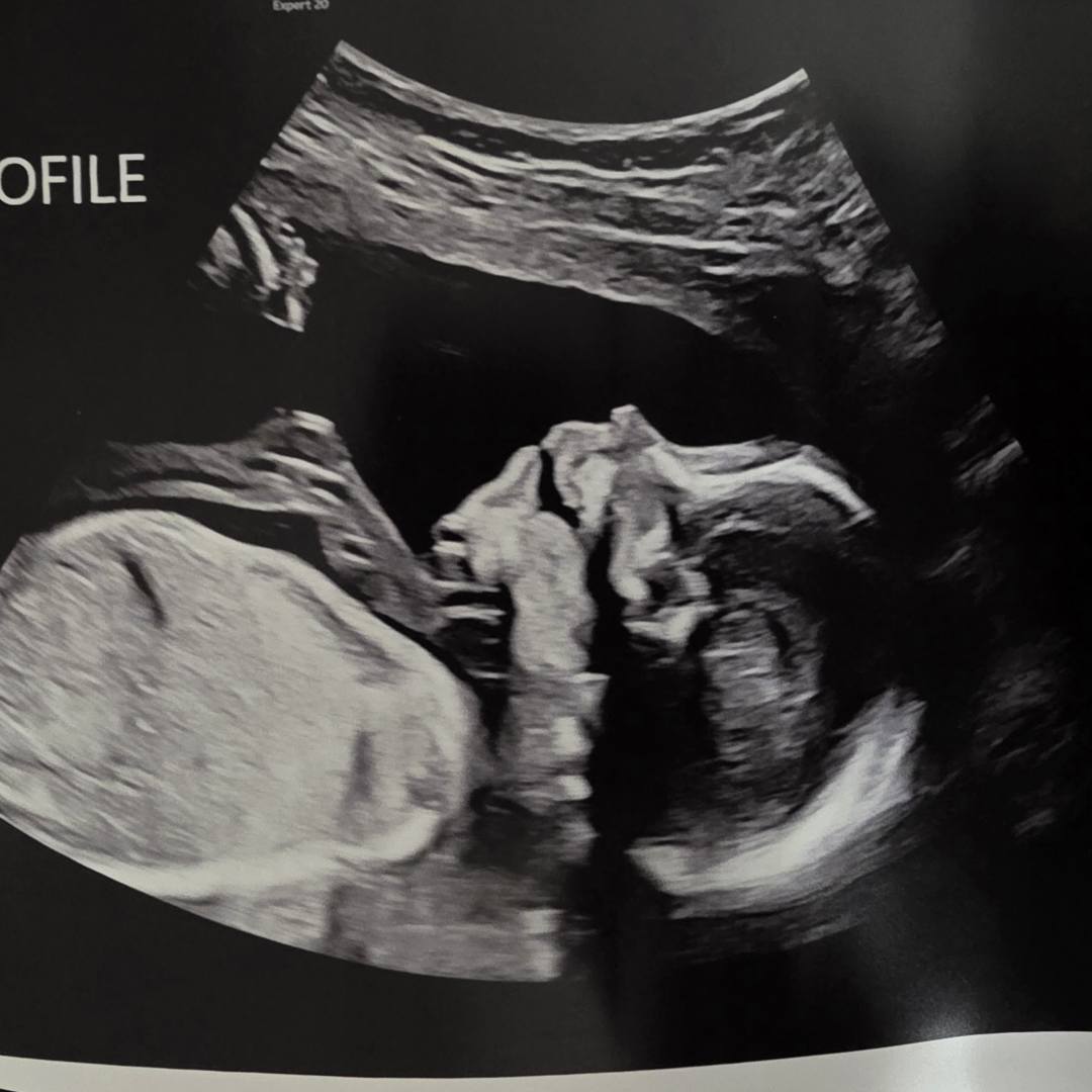 Photo shared by Shienna for their Babylist baby registry.