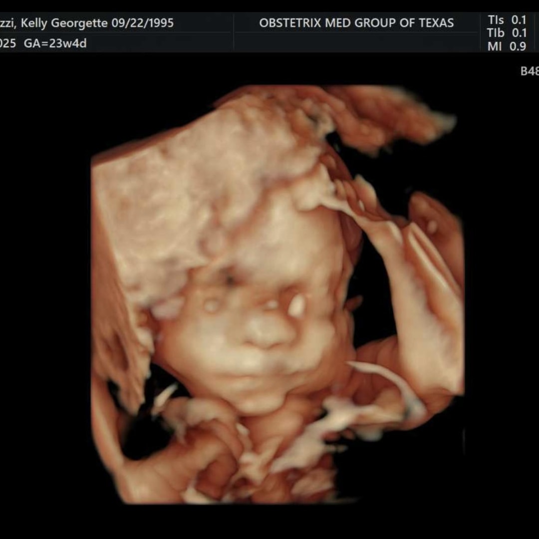 Photo shared by Kelly for their Babylist baby registry.