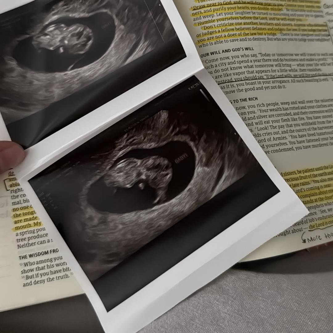 Photo shared by Sara for their Babylist baby registry.