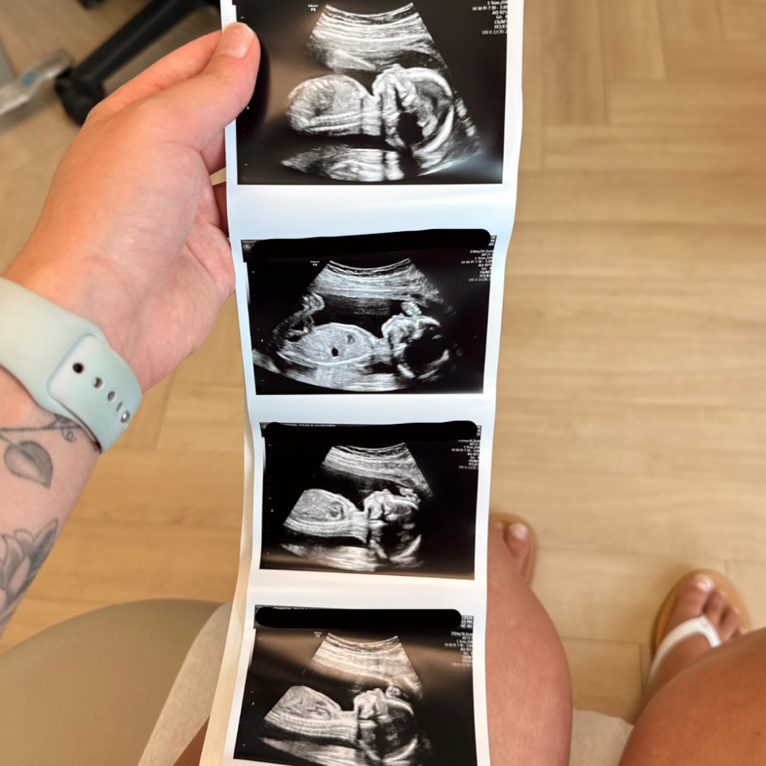 Photo shared by Tylee for their Babylist baby registry.