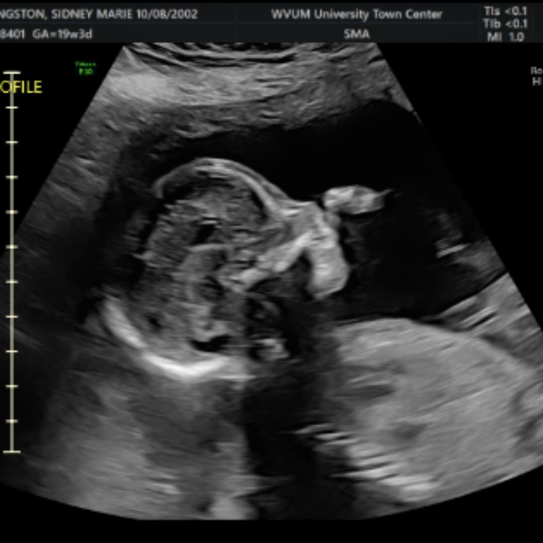 Photo shared by Sidney for their Babylist baby registry.