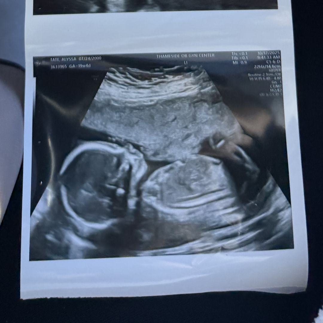 Photo shared by Alyssa for their Babylist baby registry.