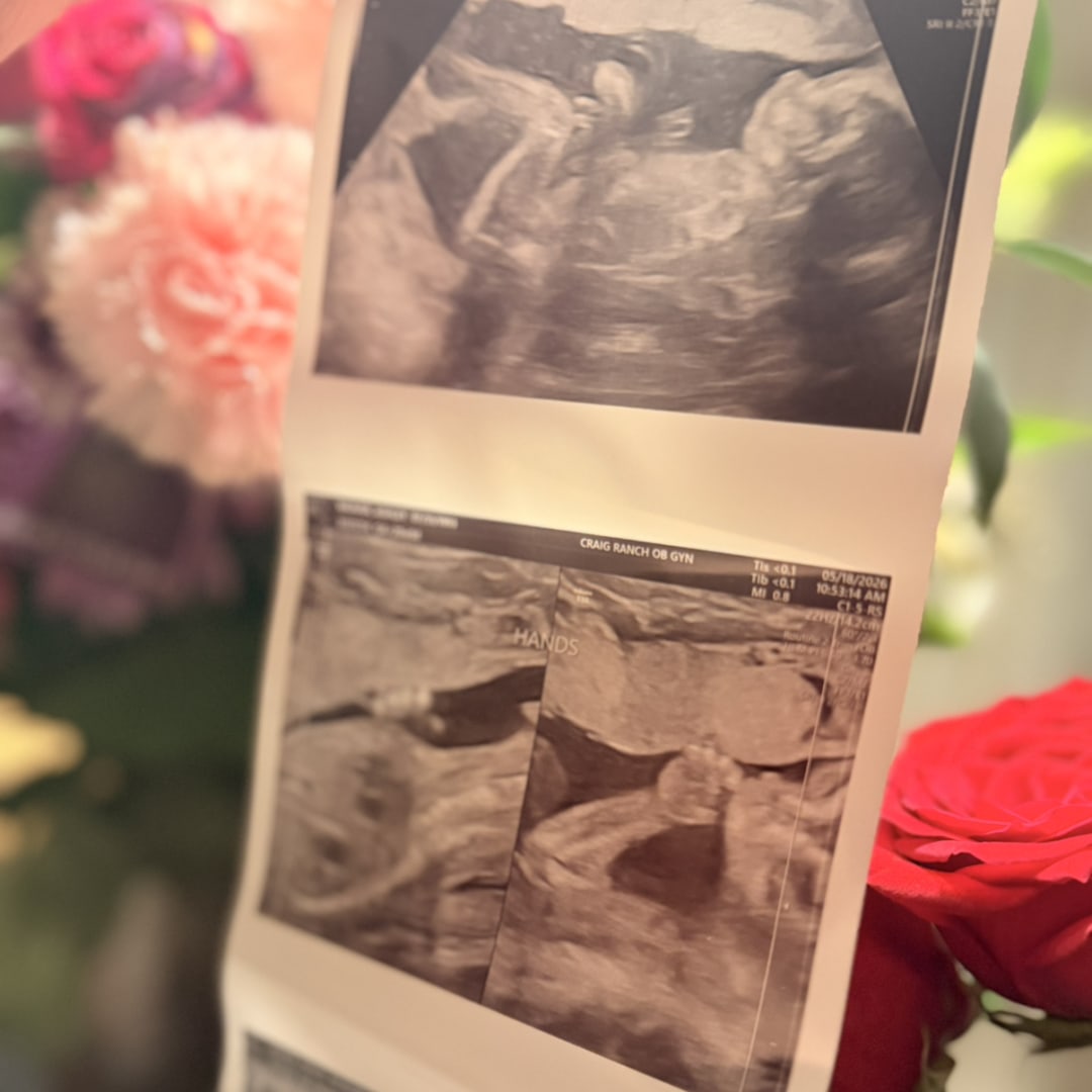Photo shared by Ashley for their Babylist baby registry.