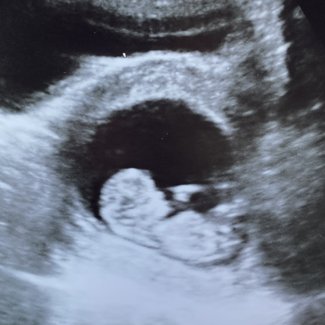 Photo shared by Jessica for their Babylist baby registry.