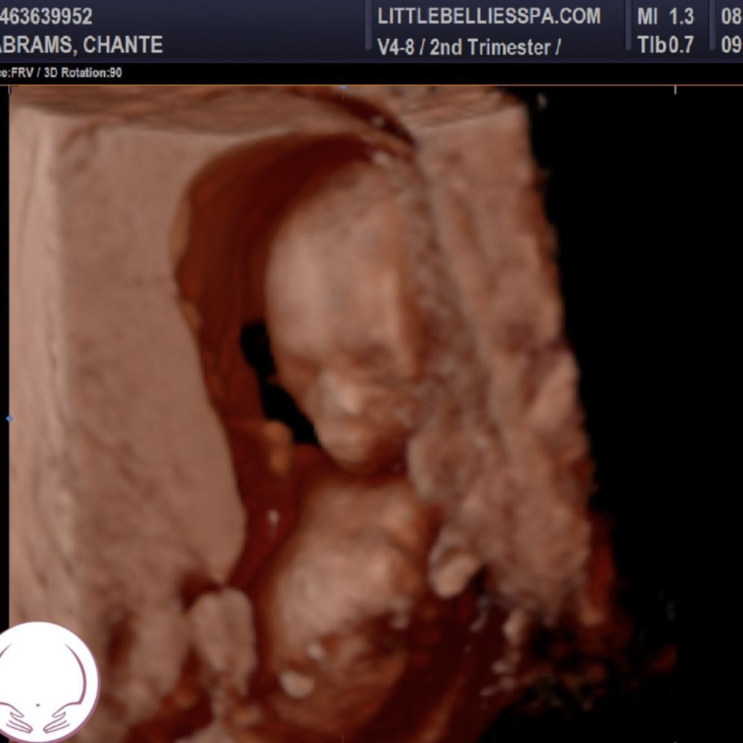Photo shared by Chante for their Babylist baby registry.