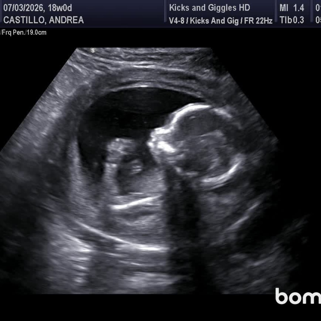 Photo shared by Andrea for their Babylist baby registry.