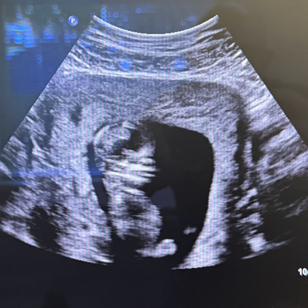 Photo shared by Areli for their Babylist baby registry.