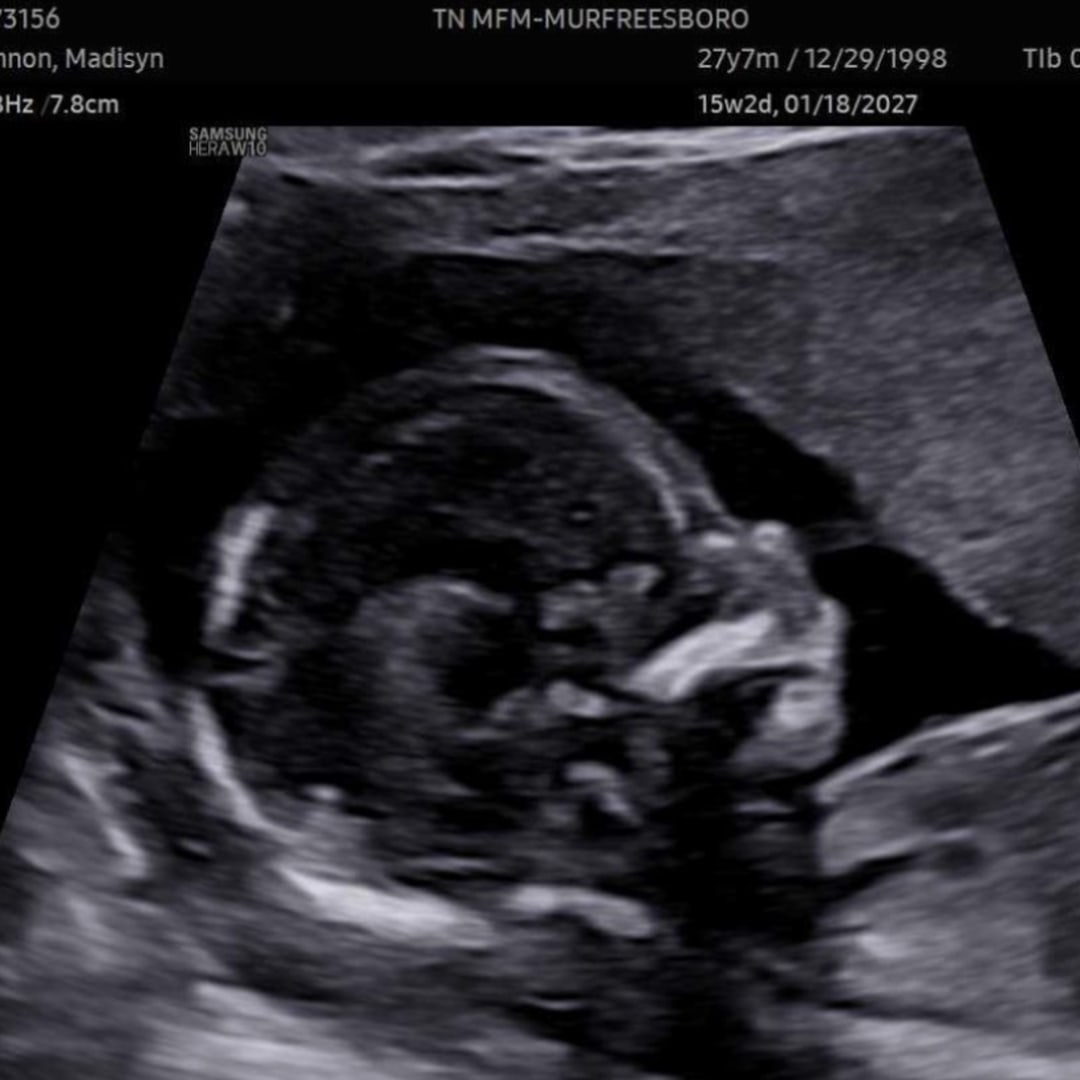 Photo shared by Madisyn for their Babylist baby registry.
