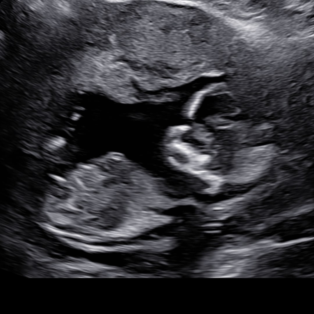 Photo shared by Andrea for their Babylist baby registry.