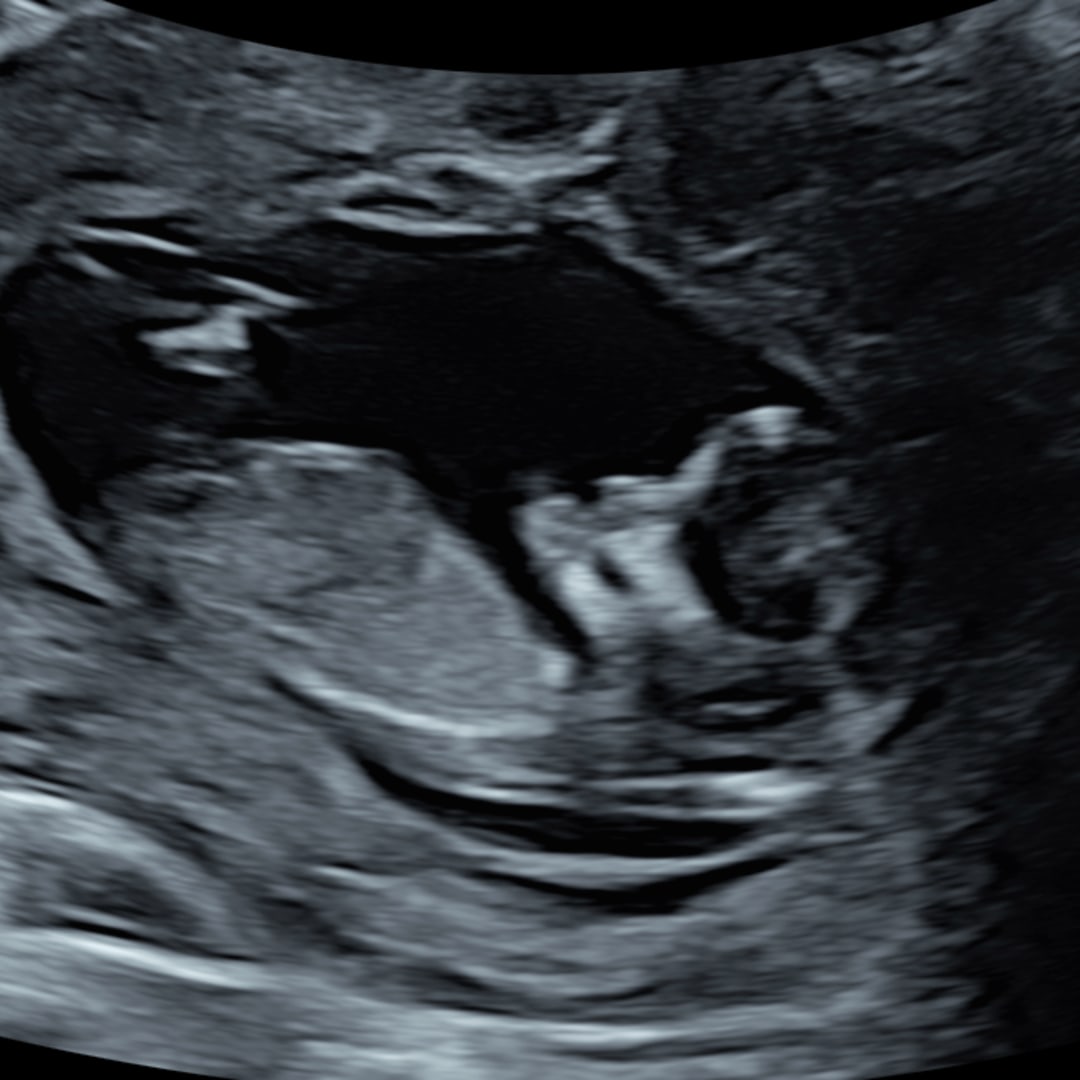 Photo shared by Autumn for their Babylist baby registry.