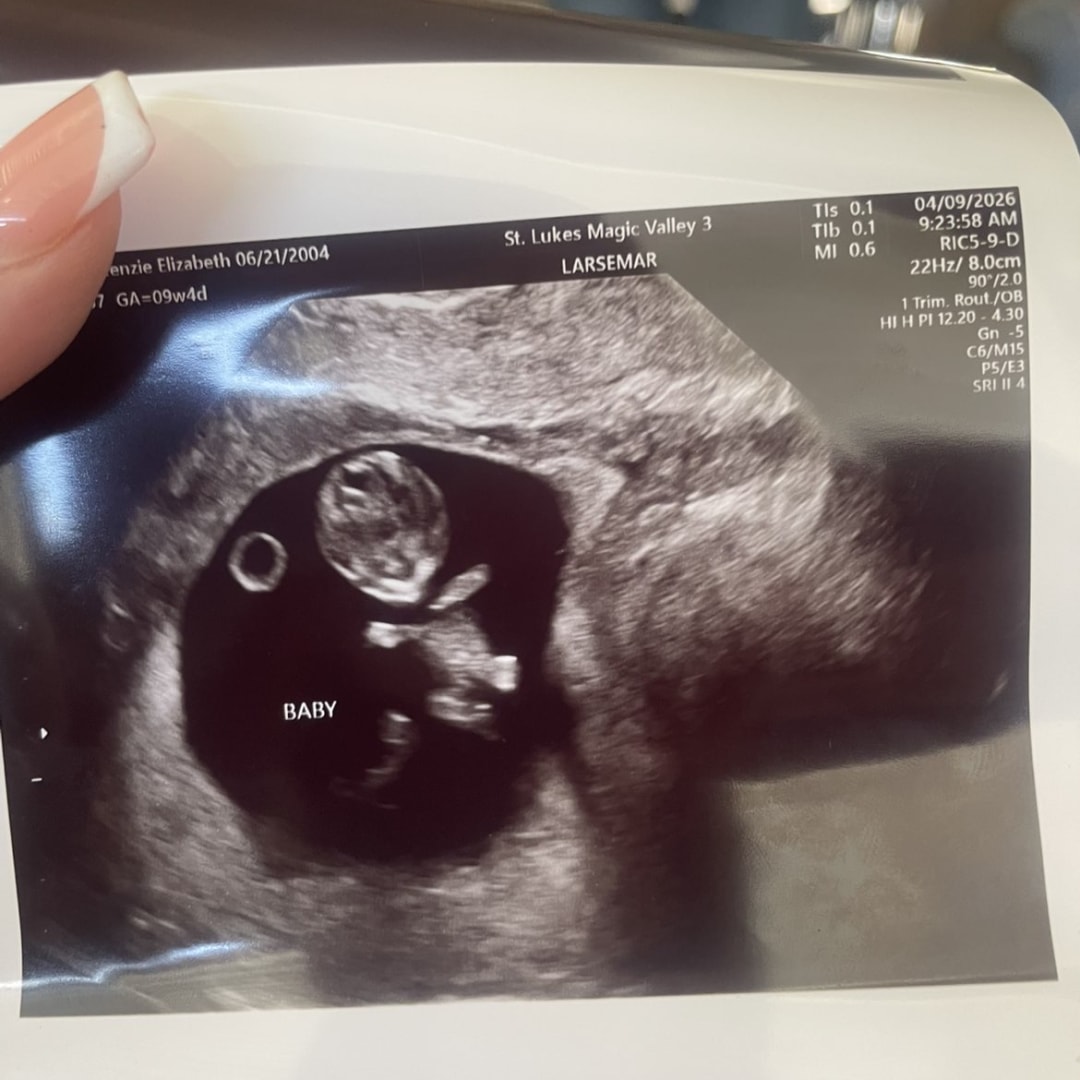 Photo shared by Mckenzie for their Babylist baby registry.