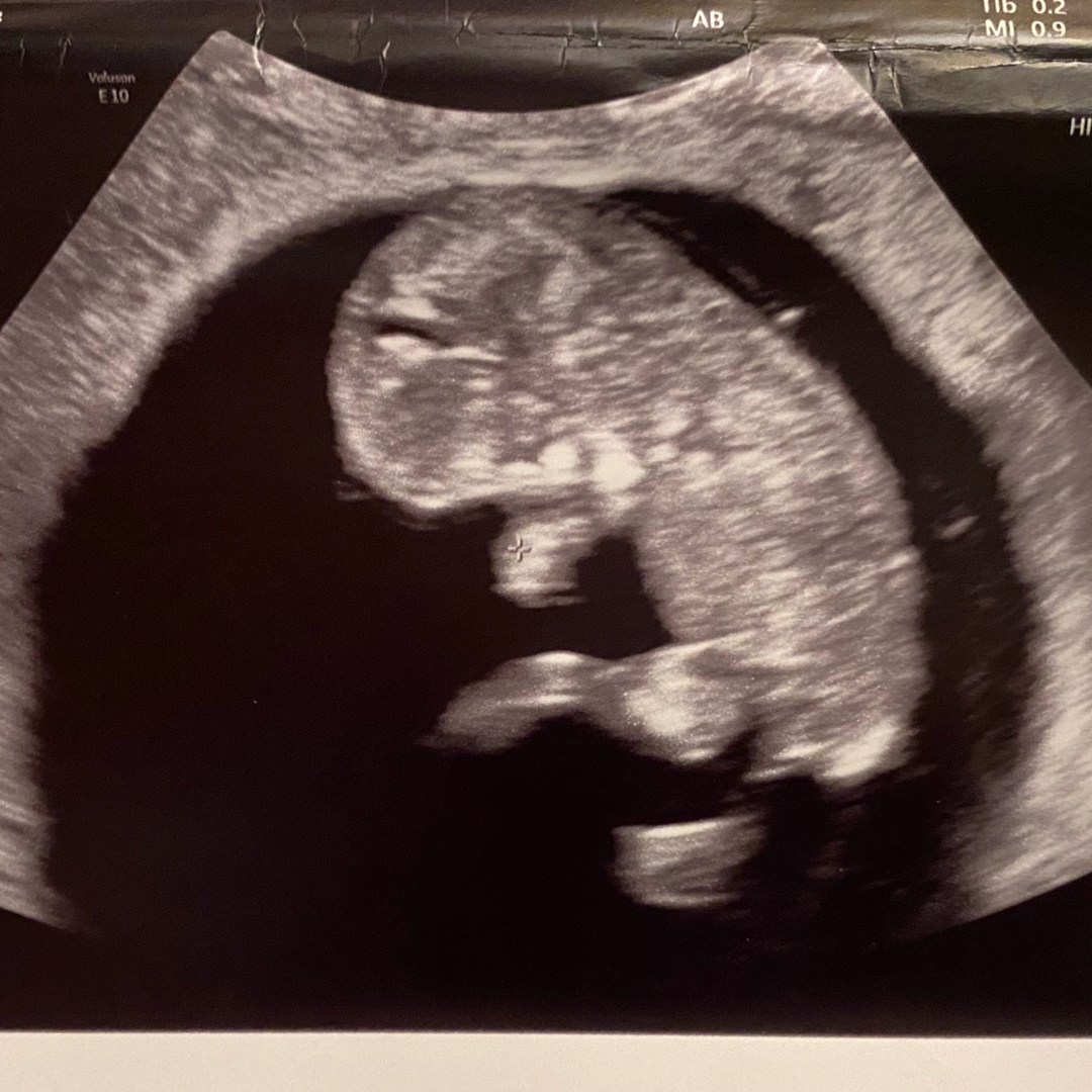 Photo shared by Jasmine for their Babylist baby registry.