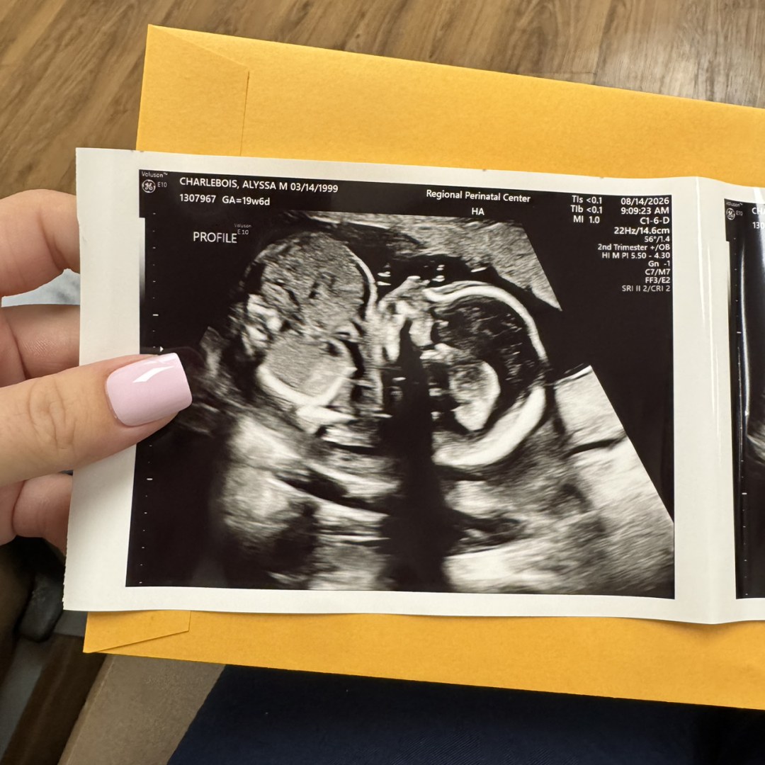 Photo shared by Aly for their Babylist baby registry.