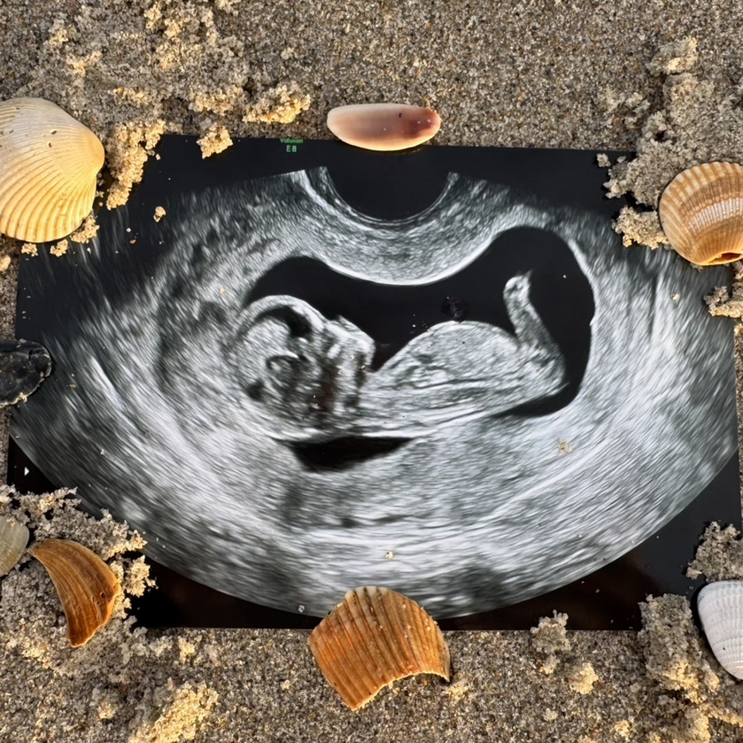 Photo shared by Kimberly for their Babylist baby registry.