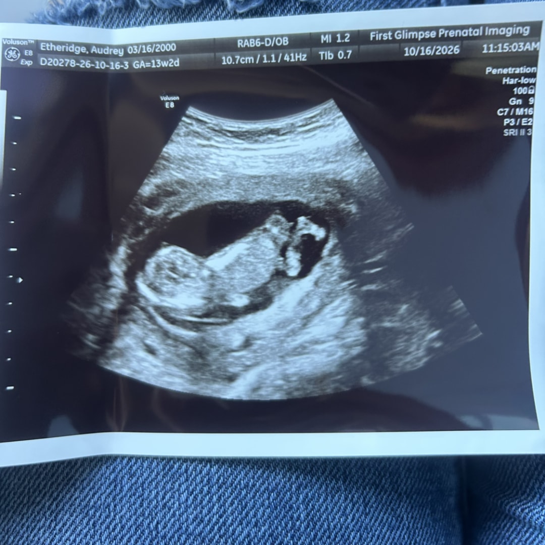Photo shared by Audrey for their Babylist baby registry.