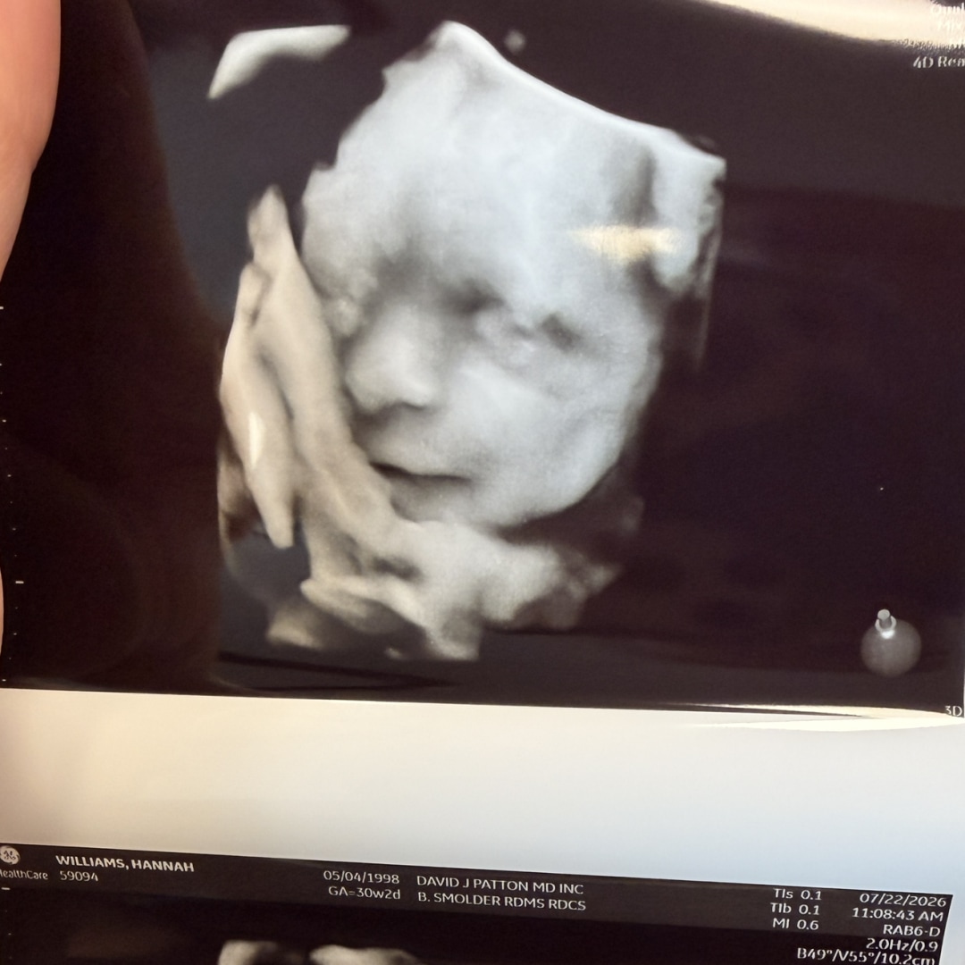 Photo shared by Hannah for their Babylist baby registry.