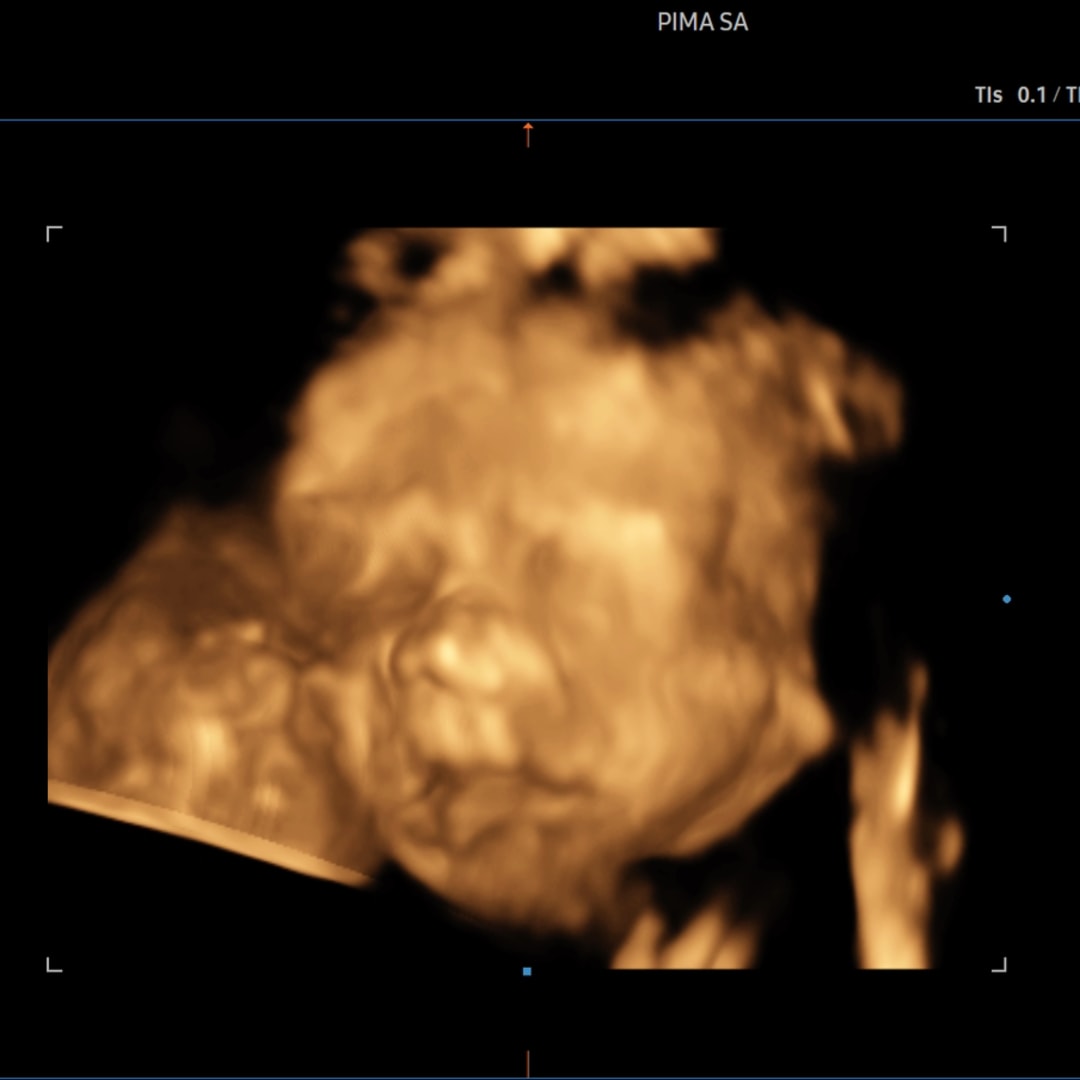 Photo shared by Ava for their Babylist baby registry.
