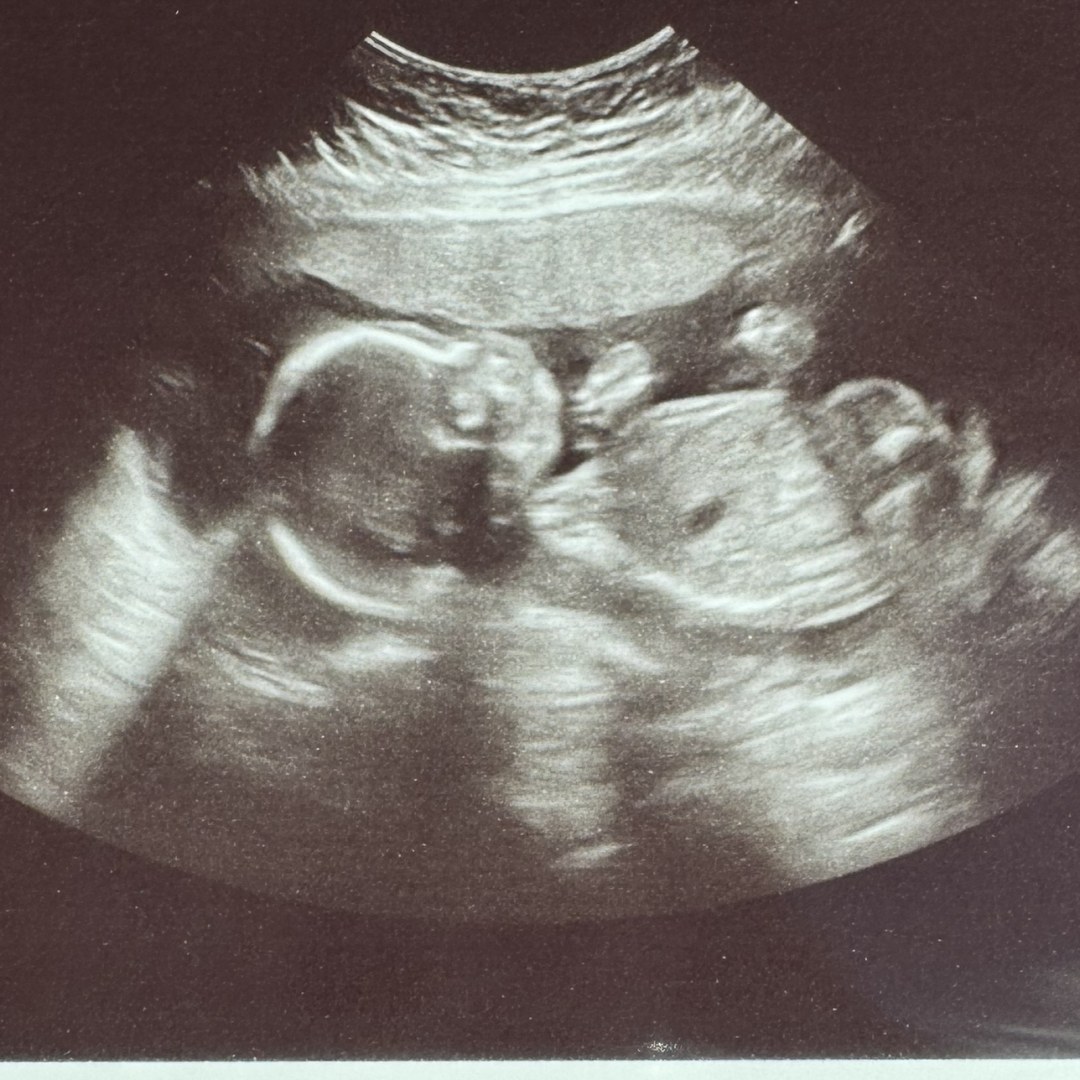 Photo shared by Danielle for their Babylist baby registry.