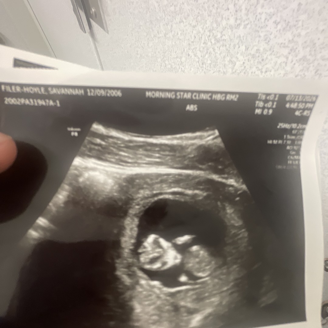 Photo shared by Christy for their Babylist baby registry.