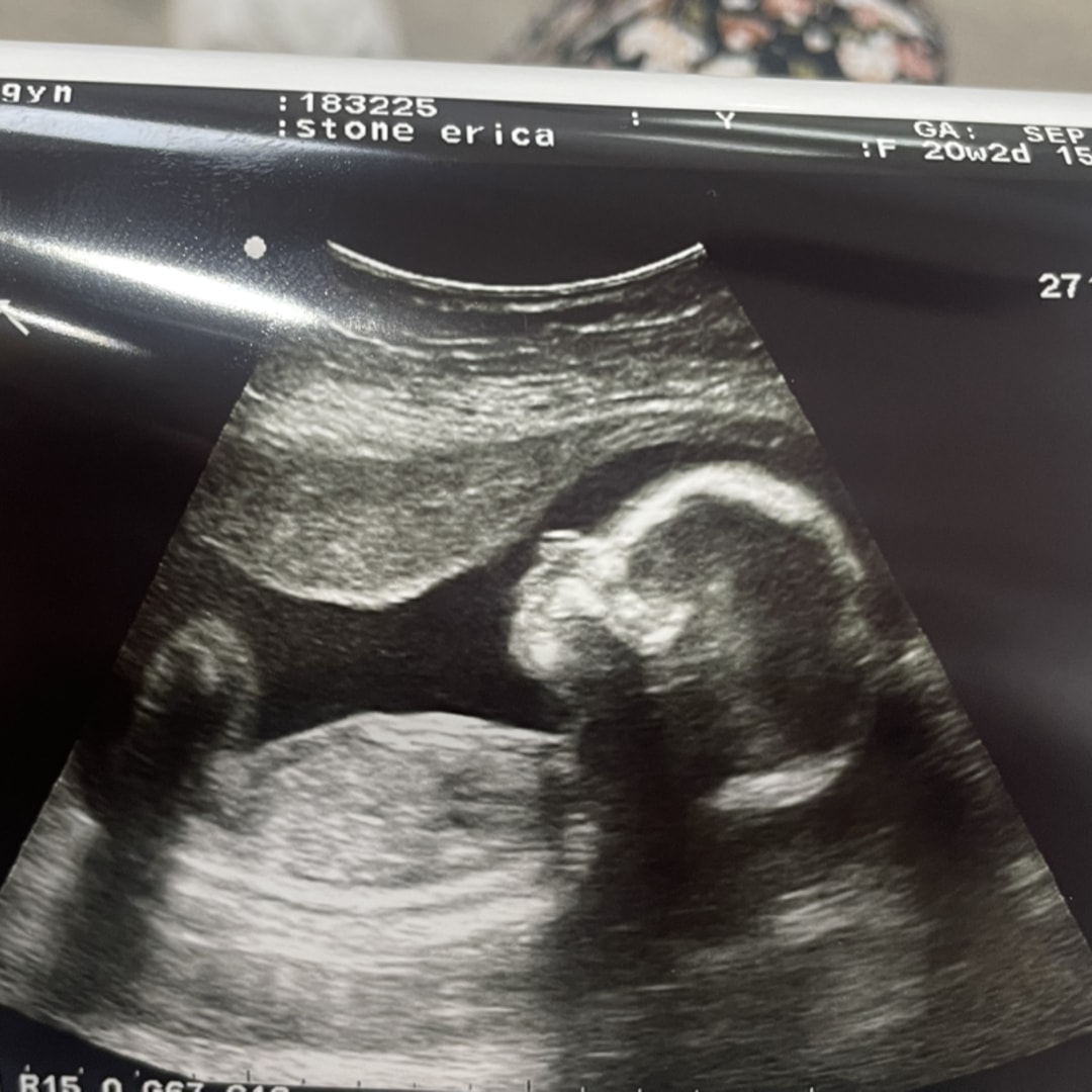 Photo shared by Erica for their Babylist baby registry.
