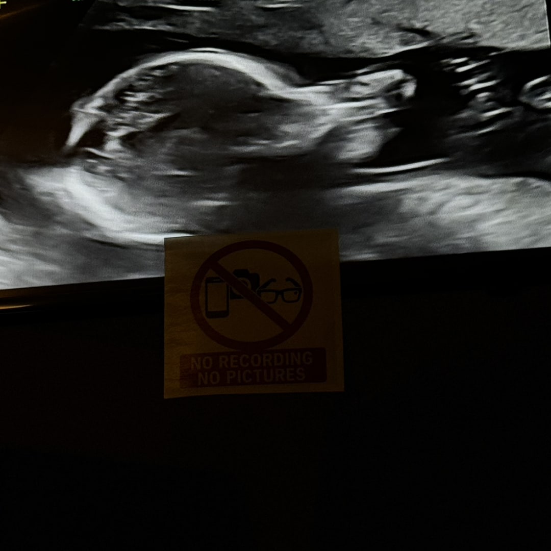 Photo shared by Elisa for their Babylist baby registry.