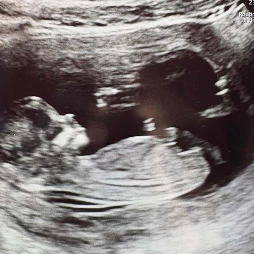 Photo shared by Kylan for their Babylist baby registry.