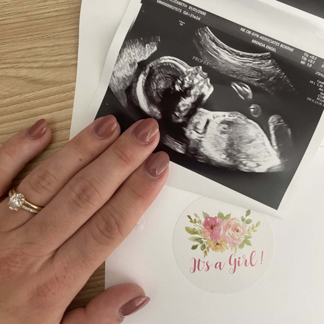 Photo shared by Elizabeth for their Babylist baby registry.