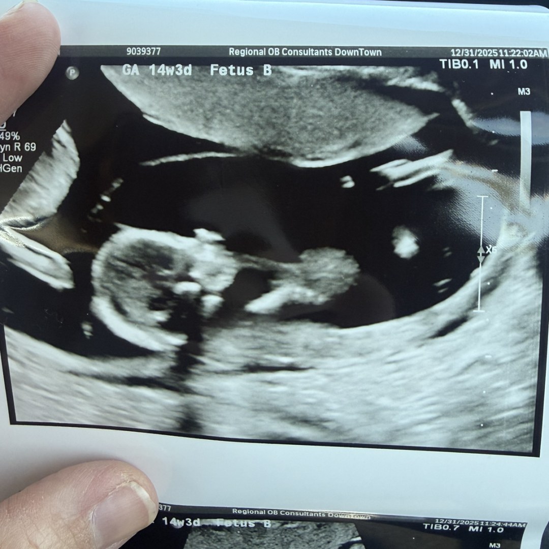 Photo shared by Rachel for their Babylist baby registry.