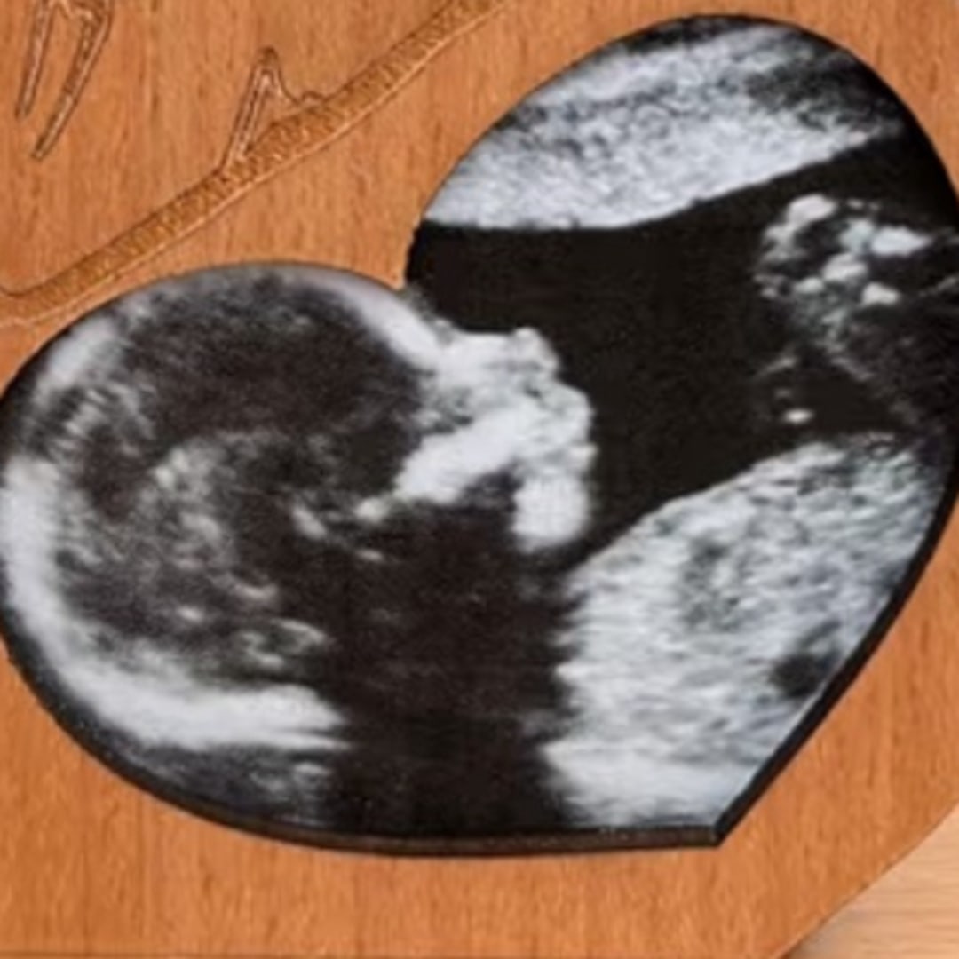 Photo shared by Abigail for their Babylist baby registry.