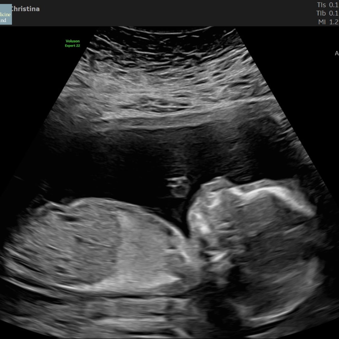 Photo shared by Christina for their Babylist baby registry.