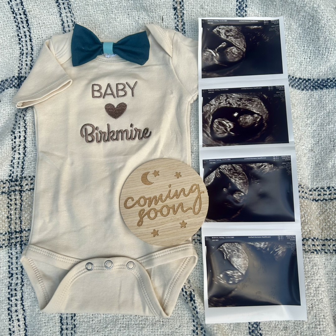 Photo shared by Ashley for their Babylist baby registry.