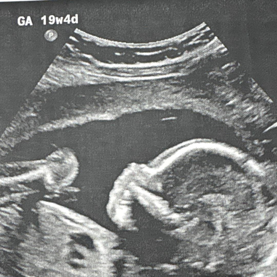 Photo shared by Destiney for their Babylist baby registry.