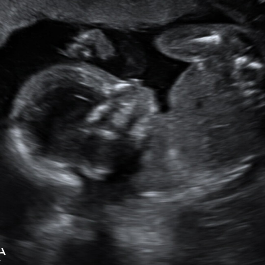 Photo shared by Alicia for their Babylist baby registry.