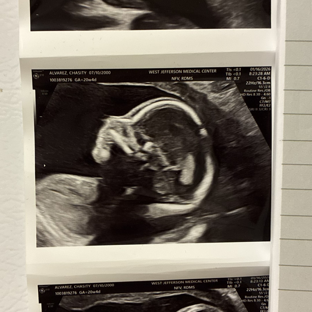 Photo shared by Chasity for their Babylist baby registry.